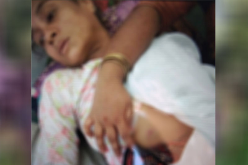 ကျောက်တော် စကခ(၉) ခြံစည်းရိုးတွင်ထောင်ထားသည့် မိုင်းပေါက်ကွဲမှုကြောင့် သားအမိနှစ်ဦး ဒဏ်ရာရ