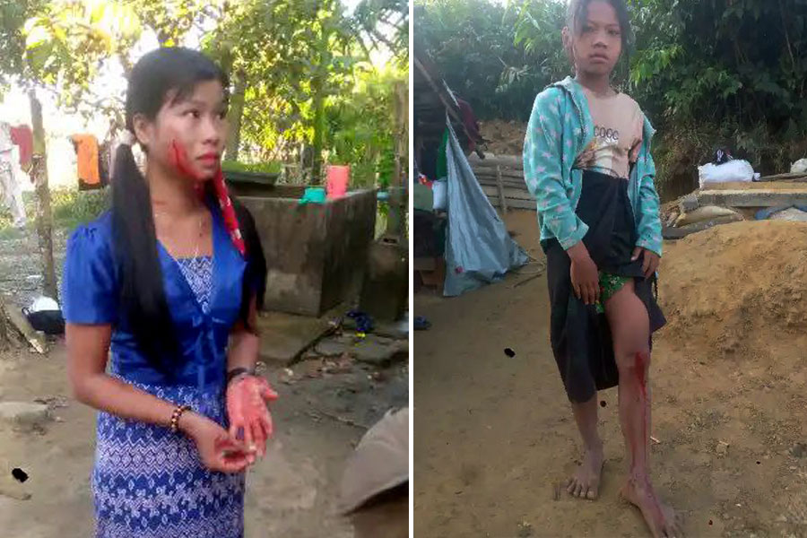 Two girls from Kainggyi (Mro) Village, Maungdaw Township, were injured in a junta artillery strike on December 31, 2023. (Photo: Supplied)