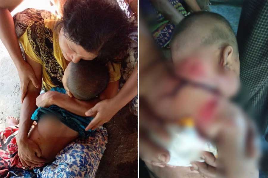 Kyauktaw residents injured by junta artillery strikes in the first week of January.