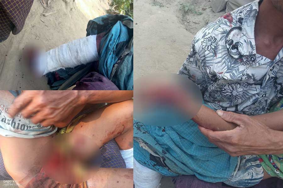 Seven children were injured in an explosion of a war remnant in Tamanthar Village, Maungdaw Township, on April 13. (Photo: APM)