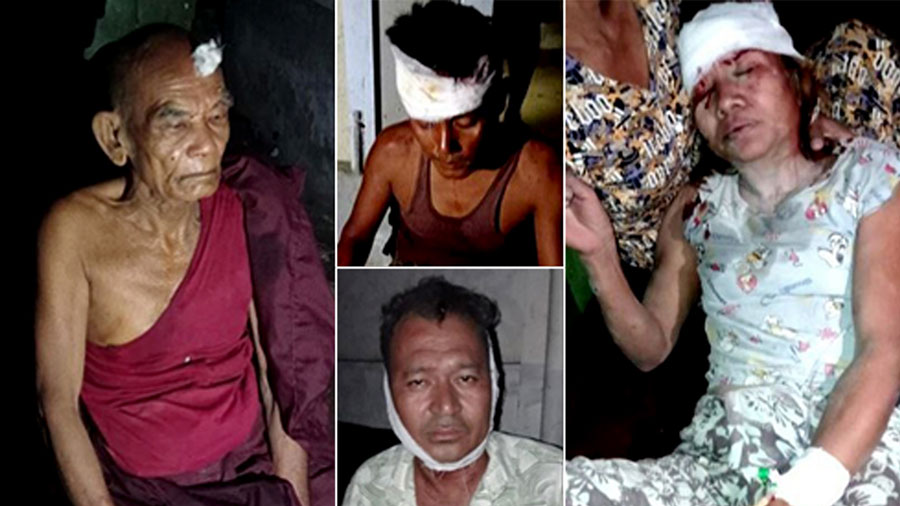Some people who were injured in a junta airstrike on Khaunglaung Village in Minbya Township on May 22. (Photo: APM)