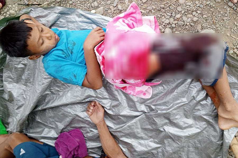 A child was injured in a junta air attack on Taronai Village in Chin State’s Paletwa Township on May 21. (Photo: APM)