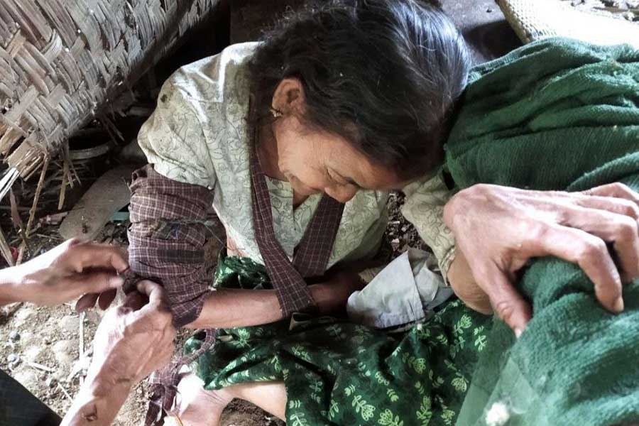 An elderly woman was among those injured in a junta airstrike on Thelkanhtaung Village, part of Arakan State’s Ann Township, on June 20. (Photo: APM)